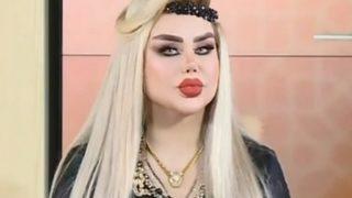 Barbie bebeğe benzemek için 43 ameliyat oldu! Sosyal medyayı ikiye böldü