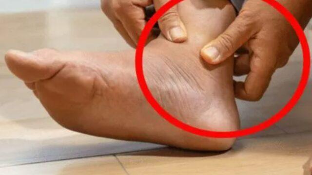 Bacak ağrısı deyip geçmeyin! Kalp hastalığının bilinmeyen 5 belirtisi