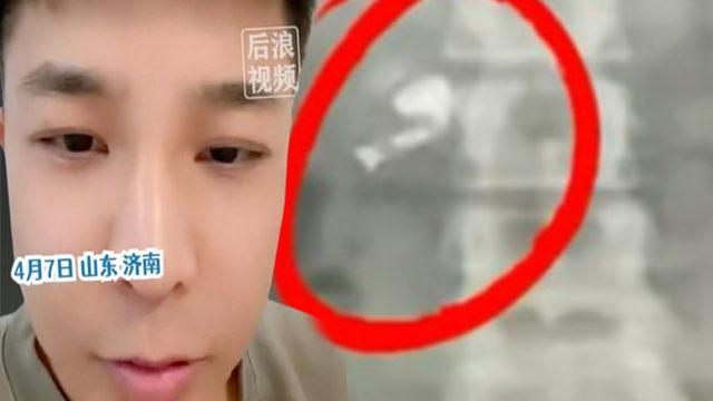 Uyurken kulaklığını yuttu! Karnından gelen müzik seslerini duyunca şoke oldu... Duruma anlam veremedi