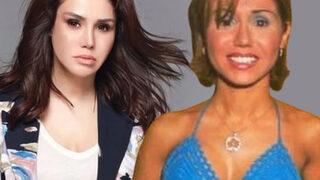 Ceylan estetiklerden mimik yapamaz hale geldi! Görenler Yazık bu ne hal dedi