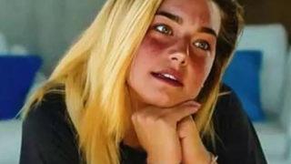 Survivor Aycan Yanaç'ın son pozlarına yorum yağdı! Yüzün uzamış resmen