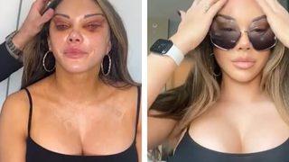 Kedi gözü ameliyatı için Türkiye'ye gelerek eleştirilerin hedefi oldu! Seksi olduğumu biliyorum