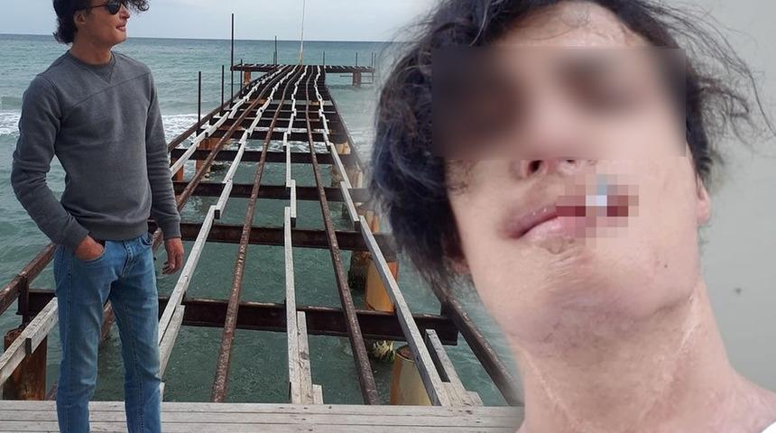 İstanbul'da akılalmaz olay! Ağrılarından kurtulmak için ameliyata girdi, kabusa uyandı: Beynine yerleştirmişler