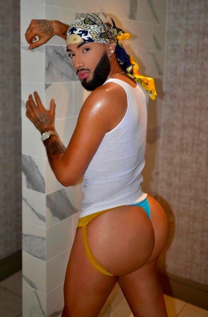 Estetik ameliyatlara servet harcayarak bambaşka biri oldu! Kalçasını büyütmek için yasadışı iğneler... “Öldürebilirler ama durmayacağım” G1