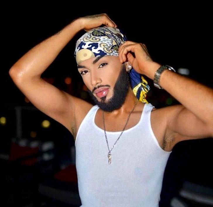 Estetik ameliyatlara servet harcayarak bambaşka biri oldu! Kalçasını büyütmek için yasadışı iğneler... “Öldürebilirler ama durmayacağım” G2