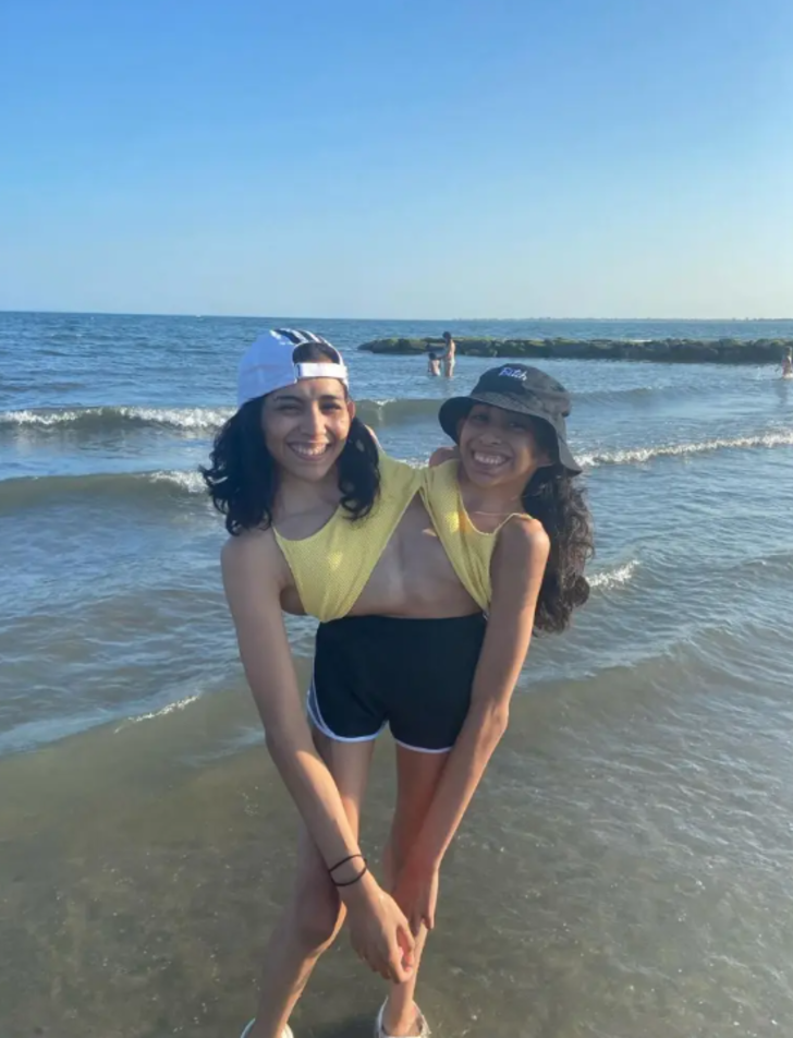 Yapışık ikizlerin cinsellik itirafı olay yarattı! “Ortak bir vajinayı kullanıyoruz ama...” G1