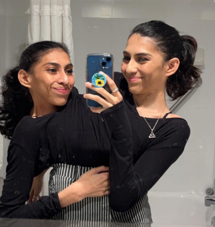 Yapışık ikizlerin cinsellik itirafı olay yarattı! “Ortak bir vajinayı kullanıyoruz ama...” G2