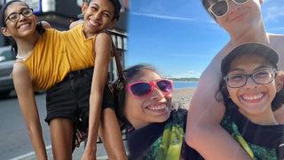 Yapışık ikizlerin cinsellik itirafı olay yarattı! “Ortak bir vajinayı kullanıyoruz ama...”