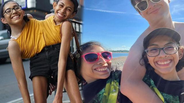 Yapışık ikizlerin cinsellik itirafı olay yarattı! “Ortak bir vajinayı kullanıyoruz ama...”