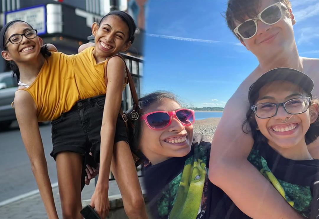 Yapışık ikizlerin cinsellik itirafı olay yarattı! &ldquo;Ortak bir vajinayı kullanıyoruz ama...&rdquo;