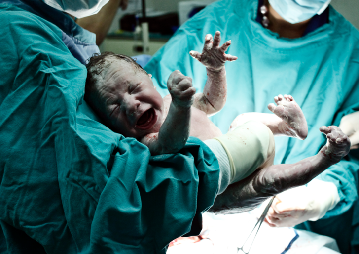 İki penisi ve anüsü olmadan doğan bebek tıp dünyasını şaşkına çevirdi! “Altı milyonda bir görülebilecek olay...”