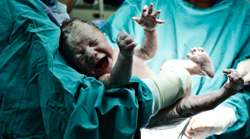 İki penisi ve anüsü olmadan doğan bebek tıp dünyasını şaşkına çevirdi! “Altı milyonda bir görülebilecek olay...”