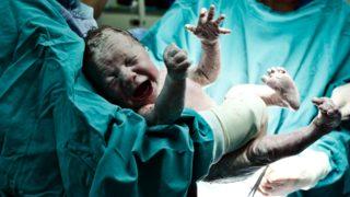 İki penisi ve anüsü olmadan doğan bebek tıp dünyasını şaşkına çevirdi! “Altı milyonda bir görülebilecek olay...”