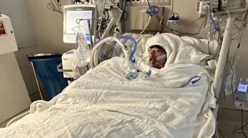 TikTok meydan okuması kabusla bitti! Dakikalar içinde alevlerin ortasında kalarak tanınmaz hale geldi