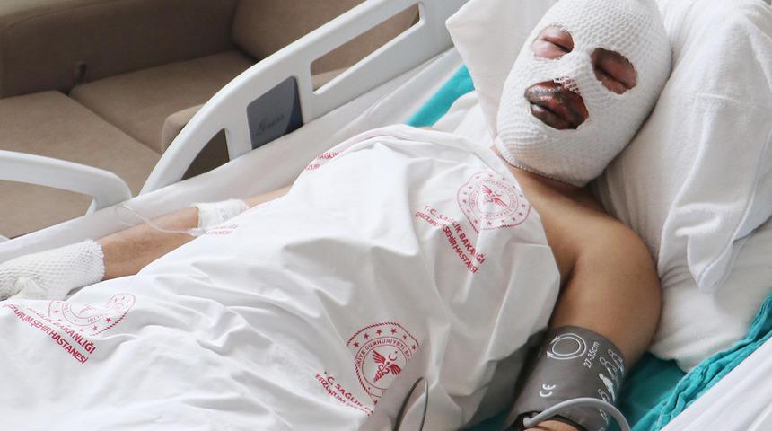 Ardahan'da zift tankında patlama! Dehşet anlarını anlattı: 'Her şey bir anda oldu'