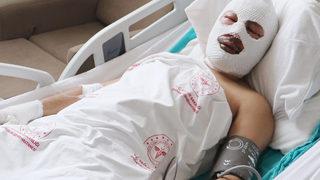 Ardahan'da zift tankında patlama! Dehşet anlarını anlattı: 'Her şey bir anda oldu'