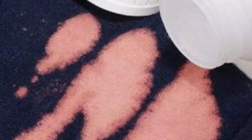 &Ccedil;amaşır suyu lekesini &ccedil;ıkarmak &ccedil;ok kolay! Kıyafetlerinizi &ccedil;&ouml;pe atmaya gerek kalmayacak