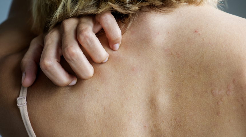 Karaciğer kanserinin bilinmeyen belirtisi! Özellikle geceleri artış görülüyor...