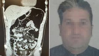 Midesinde uyuşturucuyla yakalandı, savunması şaşkına çevirdi! “Ben içici değil, yutucuyum”