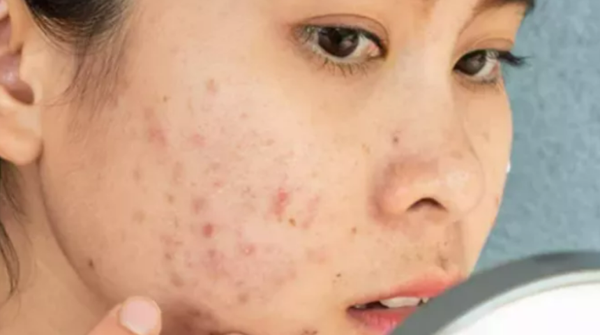 Farkında değilsiniz ama cildinizi mahvediyor! Yüzünüze asla sürmemeniz gereken ürünler