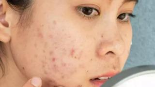 Farkında değilsiniz ama cildinizi mahvediyor! Yüzünüze asla sürmemeniz gereken ürünler