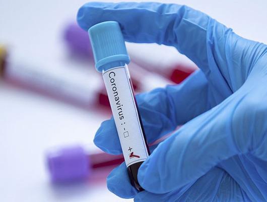 DSÖ'den flaş koronavirüs açıklaması! 'Artık acil sağlık durumu değil'