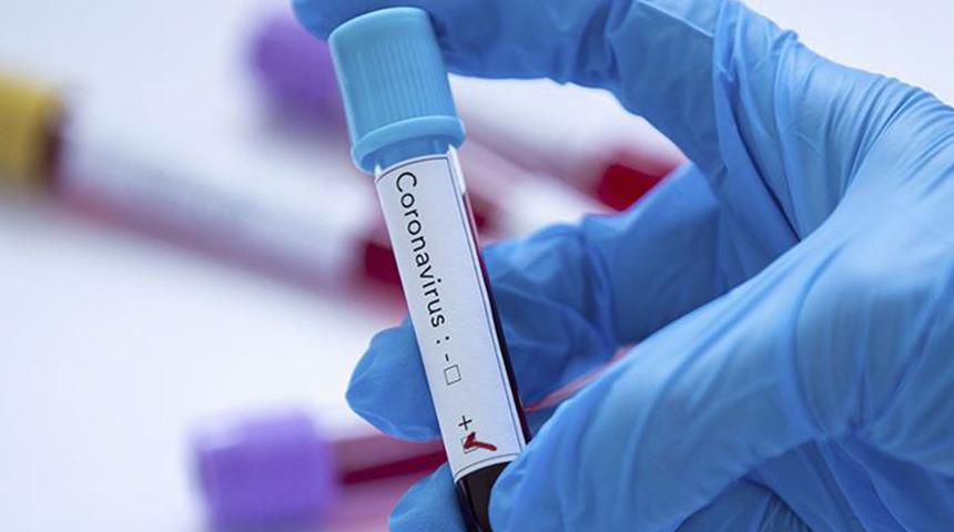 Son dakika: Dünya Sağlık Örgütü'nden flaş koronavirüs açıklaması! 'Artık acil sağlık durumu değil'