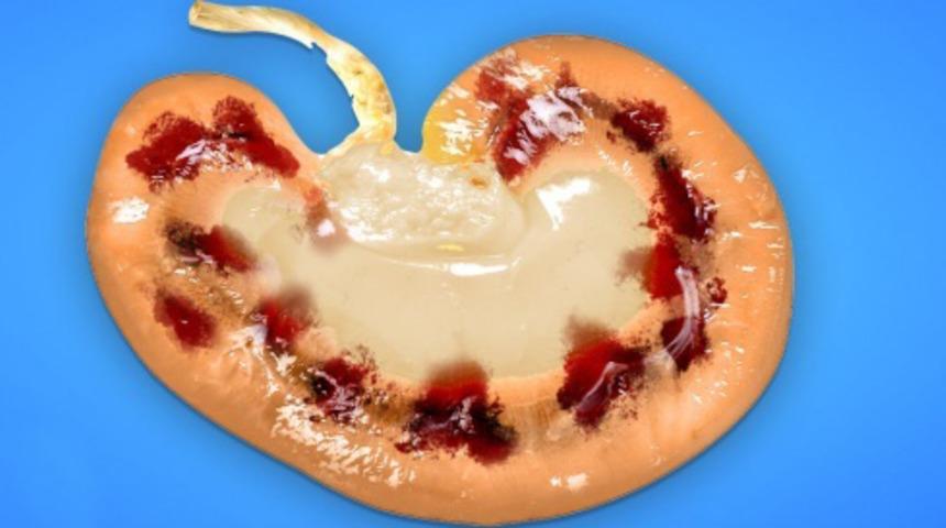 Bu belirtileri yok sayarsanız v&uuml;cudunuza olabilecek 8 şey