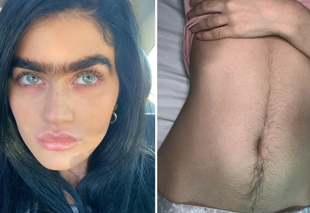 G&uuml;zellik standartlarına karşı &ccedil;ıkarak v&uuml;cudundaki t&uuml;yleri almayı bırakan 15 kadın