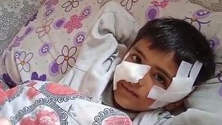 Sokak köpeği dehşeti: 6 yaşındaki çocuk kabusu yaşadı! Tam 40 dikiş atıldı