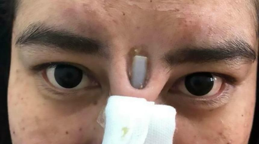 Ucuz estetik faciaya neden oldu!