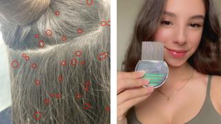 Kuaför müşterisinin saçında bulduğu bitleri paylaştı! 150 bit yumurtası milyonlarca kişi tarafından izlendi