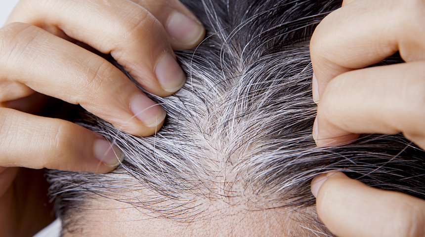 Bu yiyeceklere dikkat! Sa&ccedil;ınızı erken yaşta bembeyaz yapıyor