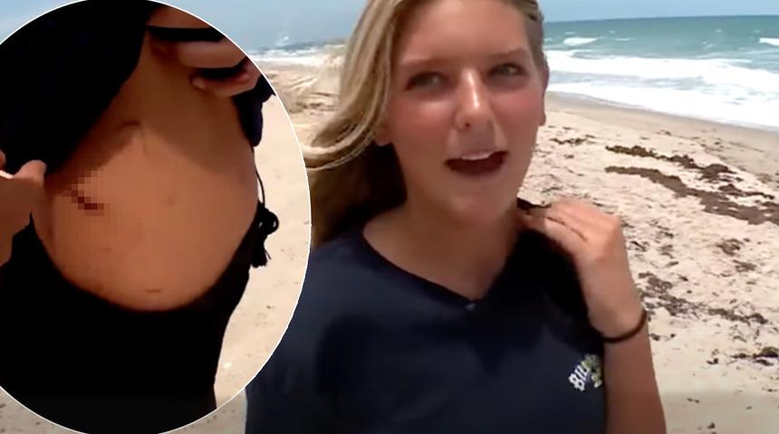 13 yaşındaki kız okyanusta yüzdüğü sırada köpek balığı saldırısına uğradı! Dakikalarca mücadele etti... Canını zar zor kurtardı