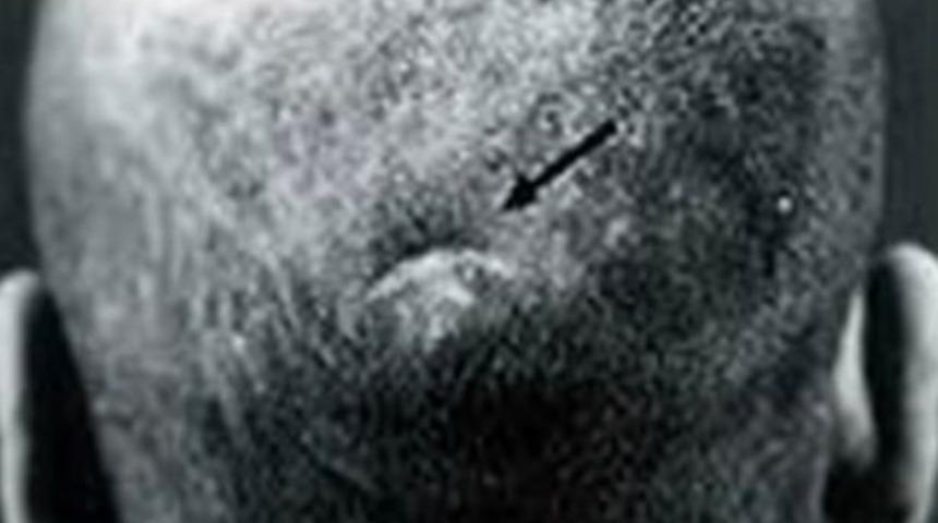 Tıp dünyasını bile şaşkına çevirdi! Başından vurulduktan sonra mucizevi bir şekilde hayatta kalan adam ters görmeye başladı