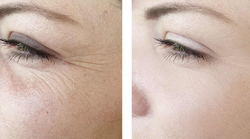 Gençleşmek için servet harcamanıza gerek yok! Bu yağ gençlik iksiri etkisi yaratıyor