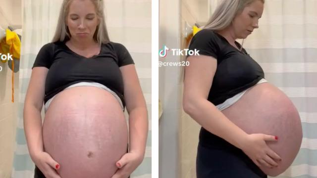 Hamile kadın devasa karnıyla hayrete düşürdü! Bu çok acı verici görünüyor