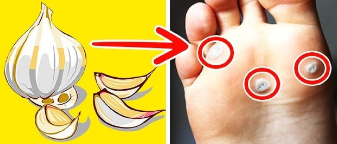 Cebinizi yormayacak ev yapımı ila&ccedil;lar