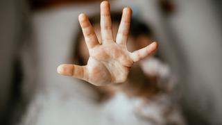 Her satırı mide bulandırıcı! Cinsel istismara uğrayan 2 yaşındaki çocuk yaşam mücadelesi veriyor