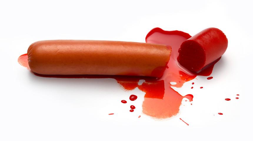 Acil doktorlarının gördüğü en acayip seks kazaları 