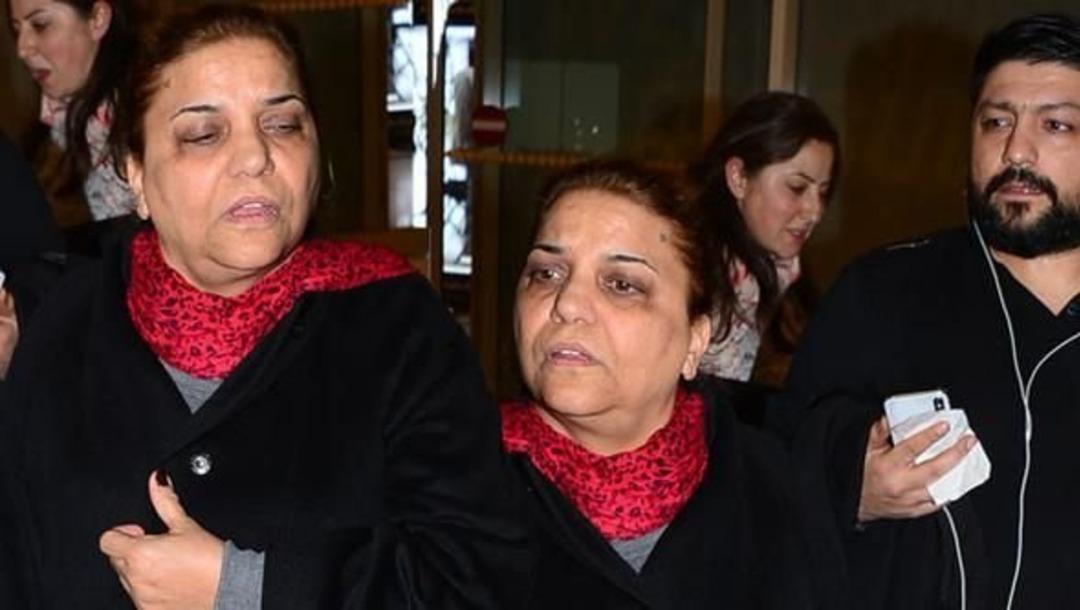 Kibariye: 'Bacaklarım tutmuyor'