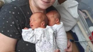 Bebekleri ikiz değil ama aynı gün doğdular! 28 gün içinde iki kez hamile kaldı... “Birbirlerinden çok farklıydılar”