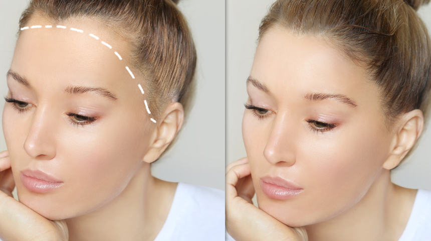 Dökülen saçları tekrardan çıkartıyor! Saç ekimi etkisi yaratan mucizevi kür