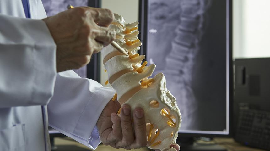 Lomber lordoz nedir, nasıl tedavi edilir? Lomber lordoz düzleşmesi ne demek?	