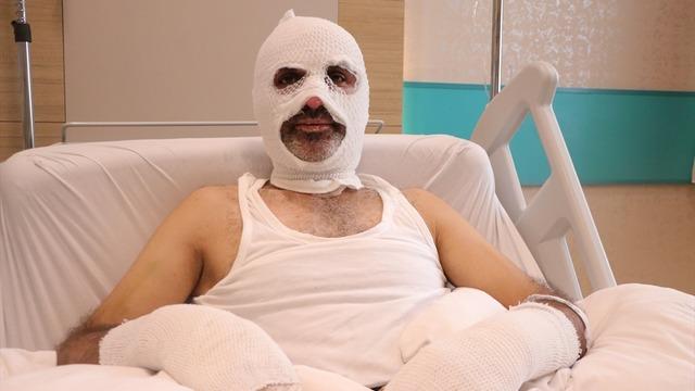 Grip olduğu için koku alamayınca... Ölümden döndü! 1 hafta sürekli olayın etkisinde kaldım, psikolojik destek aldım