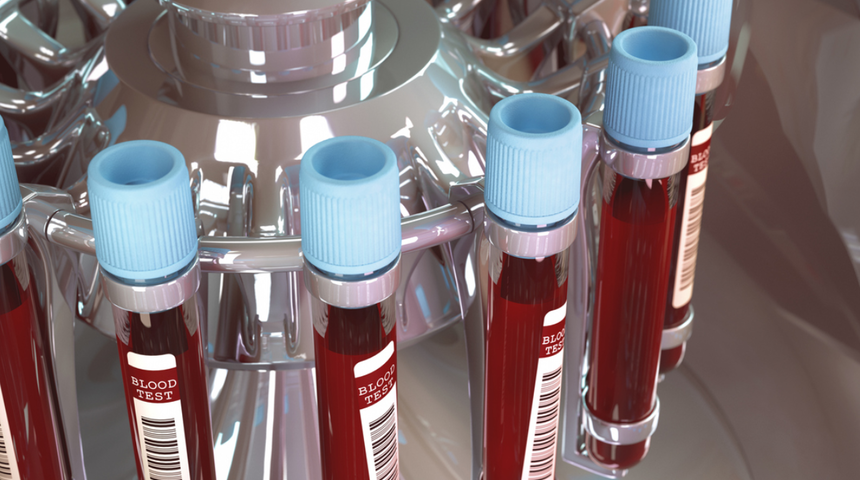 Japon bilim insanları açıkladı! Kan grubunuza göre karakter özellikleriniz ve hastalık riskleriniz! İşte en zeki kan grubu...