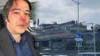 Kaçak kafeyi yıkmak için gitmişlerdi, İBB ekipleri saldırıya uğradı! Yüzünden yaralanıp hastaneye kaldırıldı