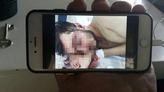 İnternetten tanıştığı iki kişi oklavayla döverek hastanelik etti