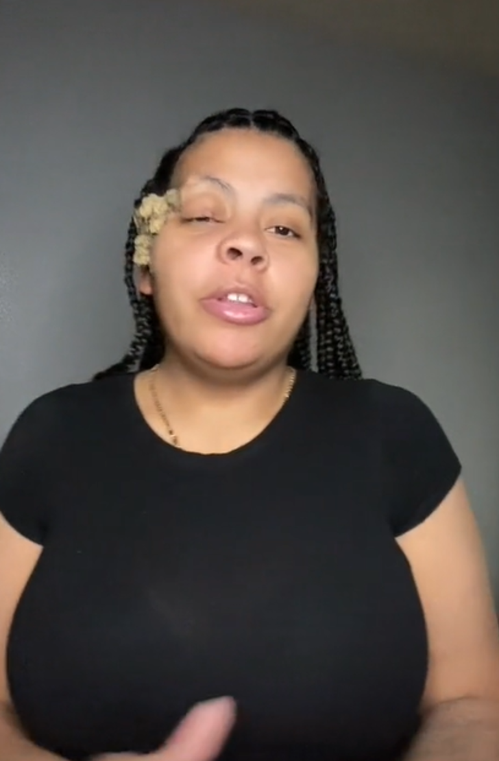 Doğum lekesi zannediyordu! Gerçek bambaşka çıktı... Tüm yüzünü kaplayınca doktor doktor gezerek çare aradı G4