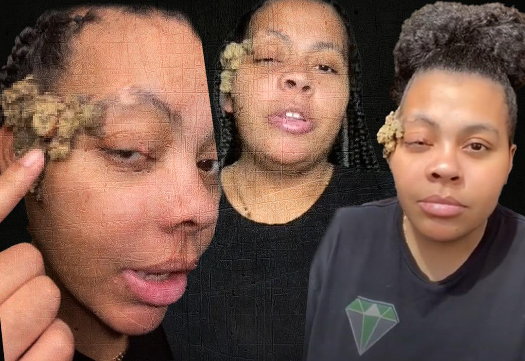 Doğum lekesi zannediyordu! Ger&ccedil;ek bambaşka &ccedil;ıktı... T&uuml;m y&uuml;z&uuml;n&uuml; kaplayınca doktor doktor gezerek &ccedil;are aradı